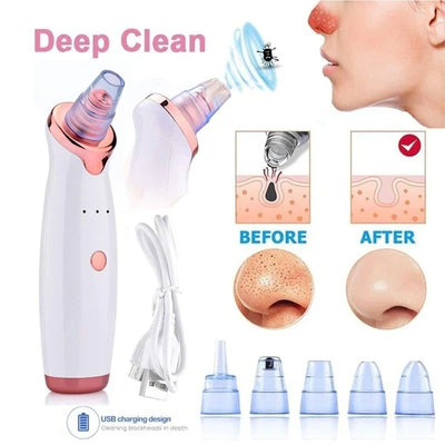 Blackhead and Pore Remover electric