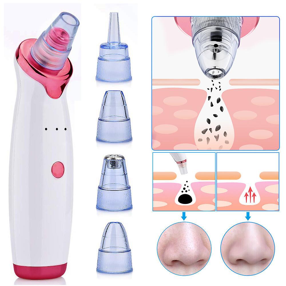 Blackhead and Pore Remover electric